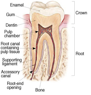 endodontic